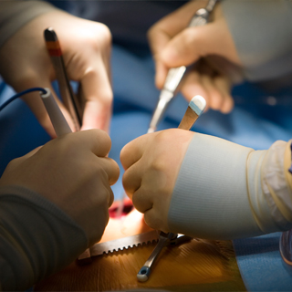 Electro Surgical